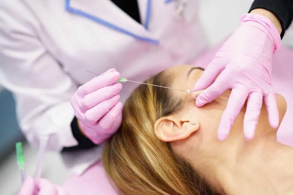 PDO Smooth Threads in Indianapolis, IN by Kanvas Medical Aesthetics