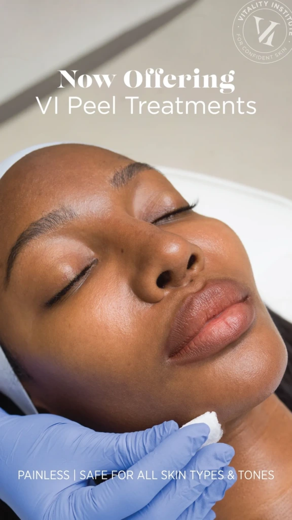 Home VI Peel Treatments at Kanvas Medical Aesthetics