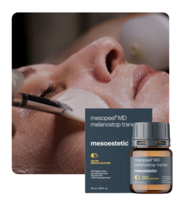 Mesopeel®