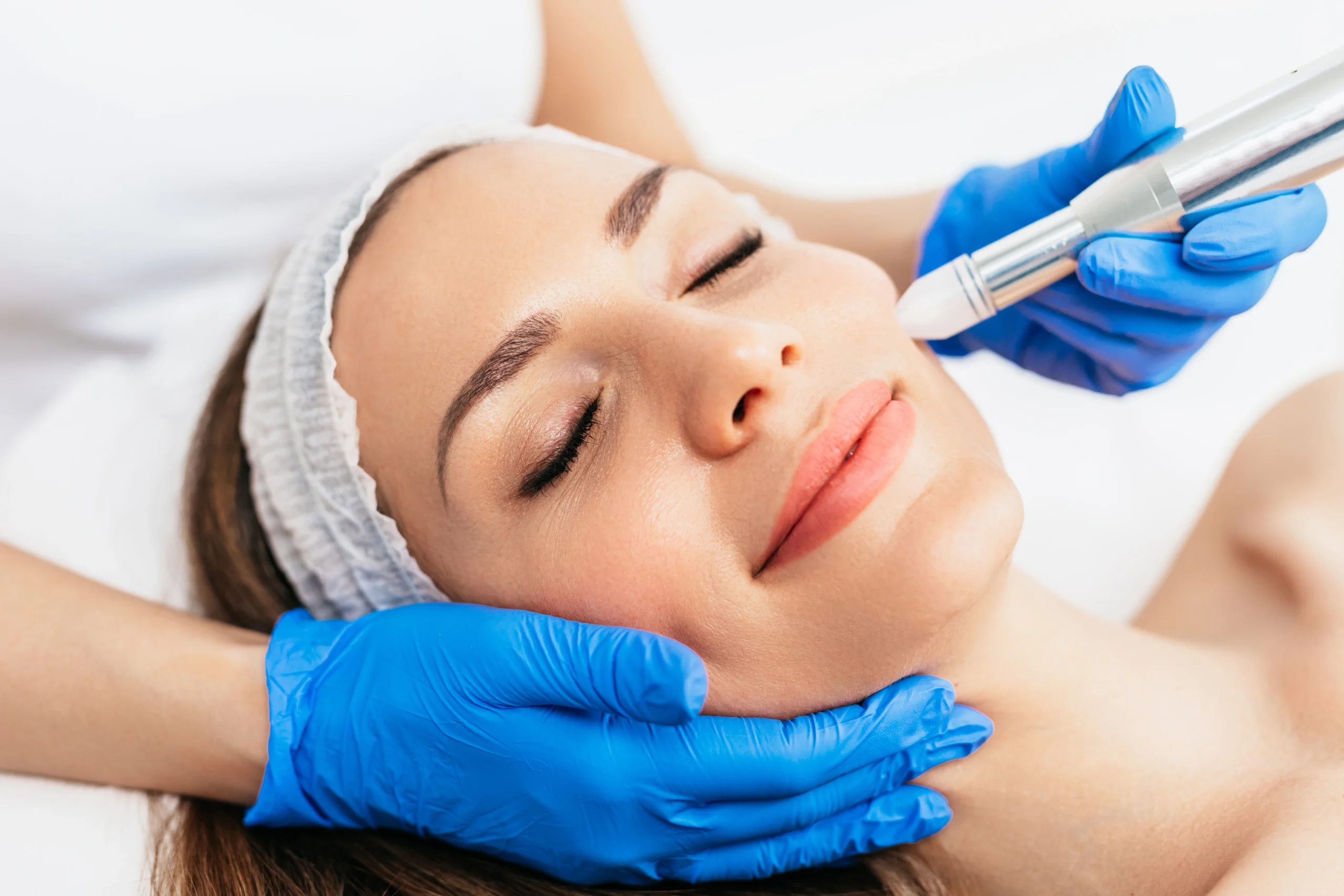Microneedling in Indianapolis, IN