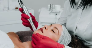 Woman receiving a microneedling treatment on her chin from an aesthetician wearing red gloves, in a professional skincare clinic setting in indianapolis, IN